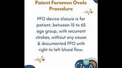 Patent Foramen Ovale (PFO) | PFO Closure Procedure Executed Successfully