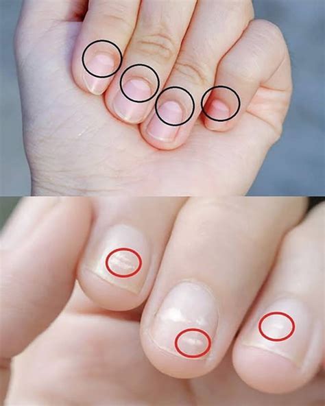 How to use baking soda to remove dark spots, wrinkles, and dark circles from your face. You’ll ...