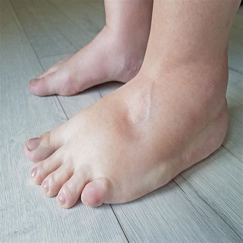 Swollen feet? Here’s what your body might be trying to tell you...