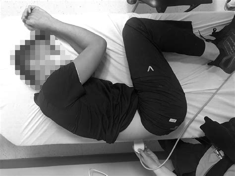 Ultrasound Measurement of the Intervertebral Space in the Lateral ...