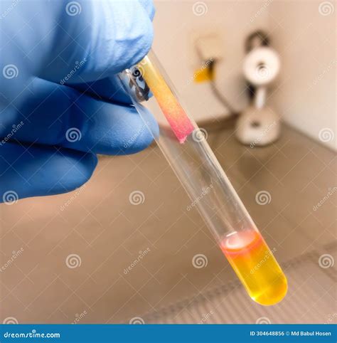 Salmonella Detection Method by Using Triple Sugar Iron (TSI) Agar in ...