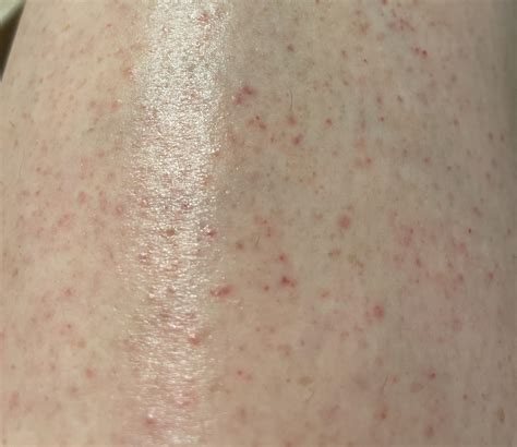 Does anyone know what these red spots are? They've appeared after ...