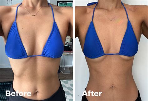 DMK Enzyme Natural Boob Lift Before & After Photos | PS Beauty - breast lift results