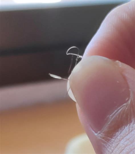 Infected Hair Follicle Pulled Out