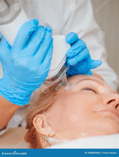 Fractional Laser Resurfacing - Laser Rejuvenation Procedure Stock Photo - Image of doctor ...