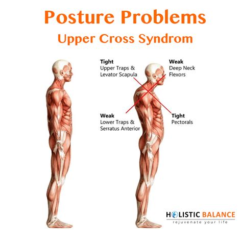 Do you ever feel an intense pain in your neck and upper back after a ...