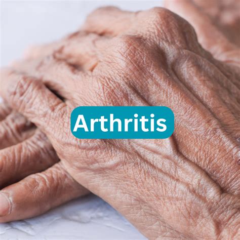 Arthritis Research • Acute & Chronic Pain Therapies