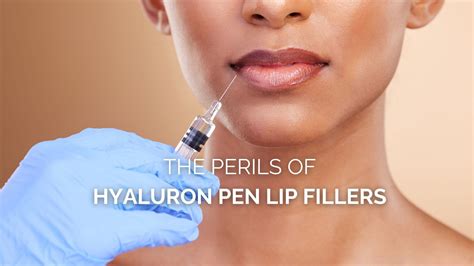 The Perils of Hyaluron Pen Lip Fillers - Aesthetic Skin Chicago