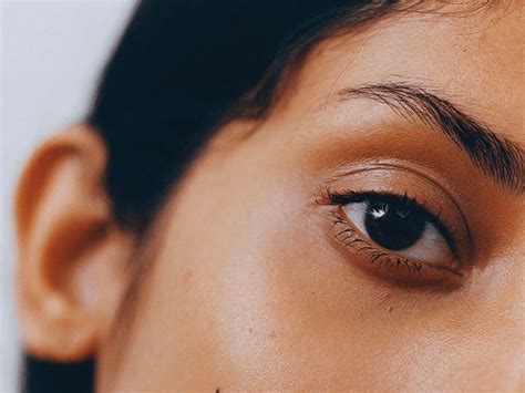 What Does Brown Spots On Eyes Mean - Infoupdate.org