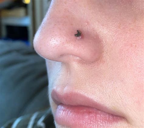 Problems With Nose Piercing Bump at Terri Whobrey blog