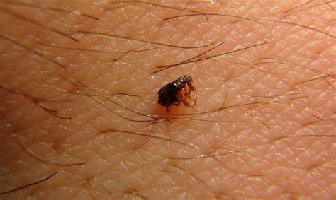 Pulgas archivos - MILCOZA, Control de Plagas