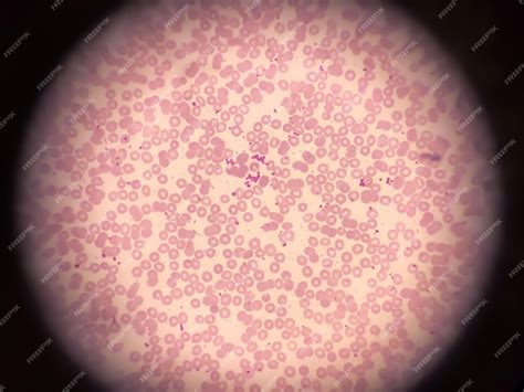 Red Blood Cells Light Microscope
