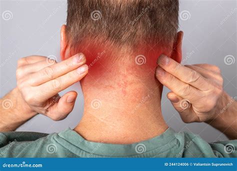 Nape Pain Closeup. Ache in Back Neck Stock Photo - Image of ache ...