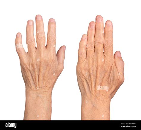 Closeup of elderly caucasian woman's hands, dorsal view with fingers spread, raised in a neat ...
