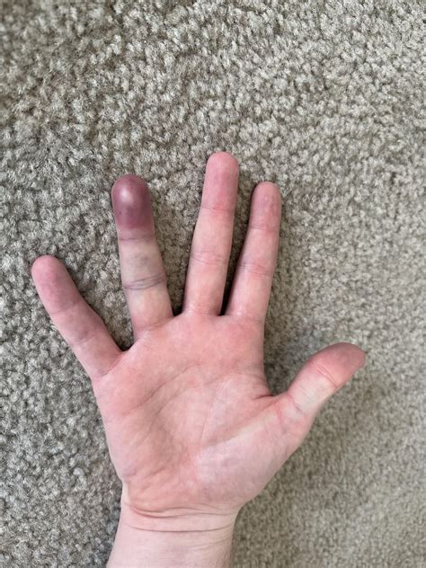 Best hockey camps in USA or Canada : r/hockeyplayers