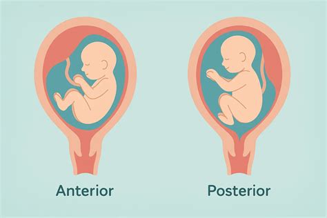 Anterior vs Posterior Placenta: What It Means