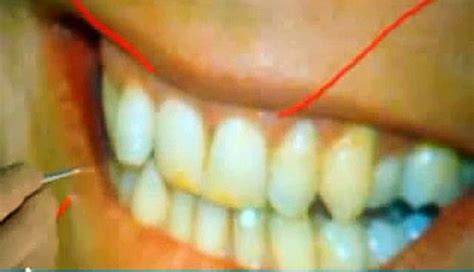 Dentes De David Bowie O Que Você Vai Ver Em Stardust, Cinebiografia