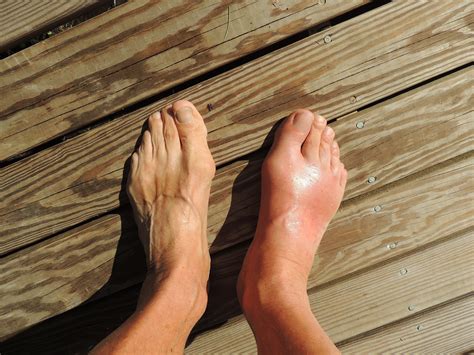 Ow, My Big Toe Hurts, Big Toe Pain? - The Foot and Ankle Clinic