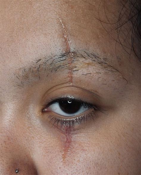 eye scar | @elliotsfx on instagram