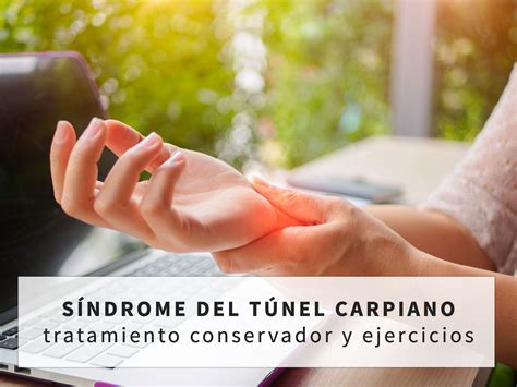 Síndrome del túnel carpiano: qué es y cómo tratarlo | ICONICA Servicios ...