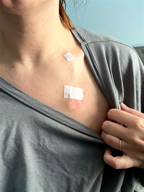 Here’s How to Sleep Better With a Chemo Port - GoodRx