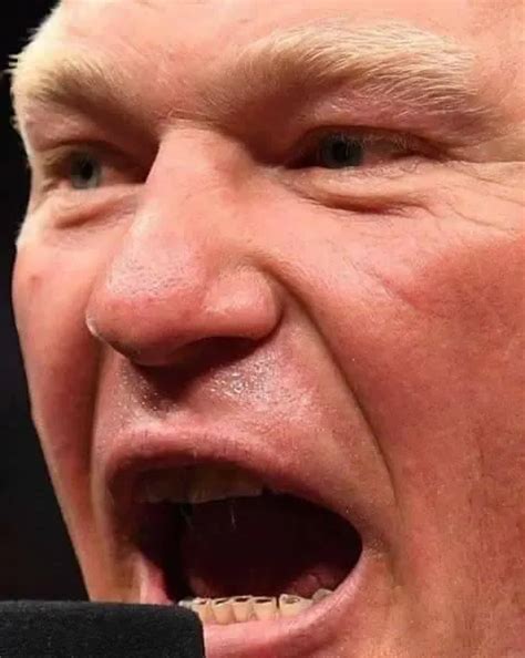 Brock Lesnar Teeth - Mystery Revealed - [2024]