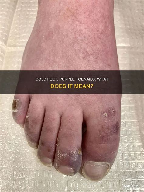 Feet Cold Meaning