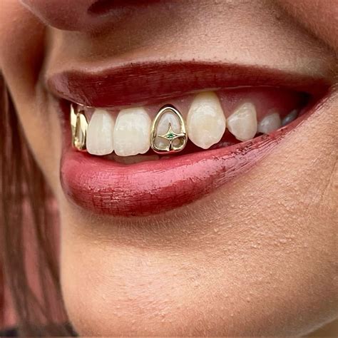 Grills | Gold teeth grillz, Grillz teeth, Grills teeth