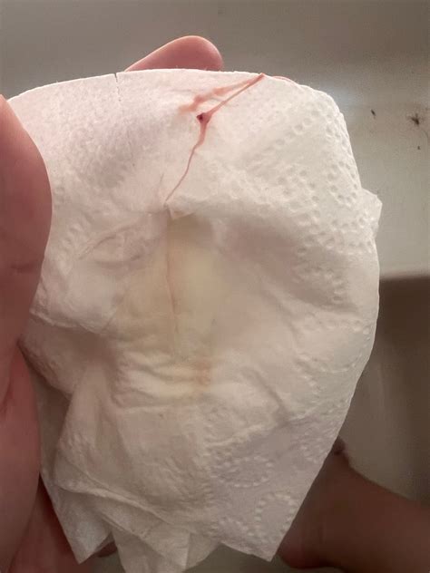 Bloody Discharge Pregnancy