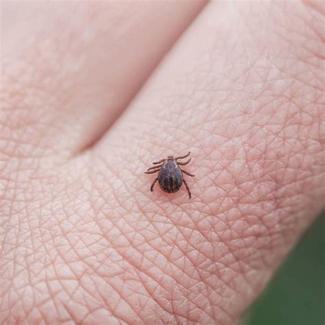 Bloedonderzoek naar de ziekte van Lyme: zo werkt dat