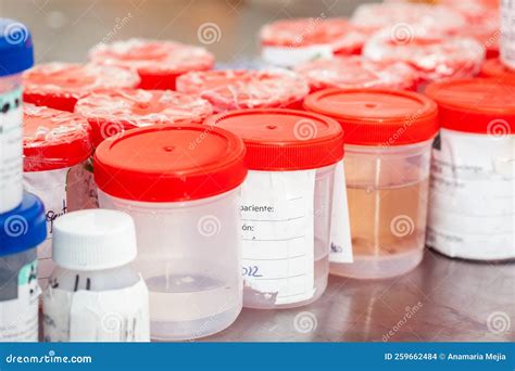 Sterile Medical Containers with Biopsy Samples Ready To Be Processed at ...