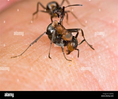 Wood ant bites deposits formic acid on human Stock Photo - Alamy