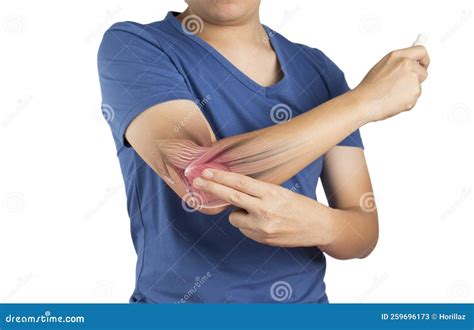 Apply Painkillers To Forearm , Forearm Muscle Pain Stock Photo | CartoonDealer.com #232971582