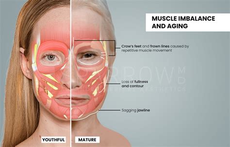 Understanding Facial Aging