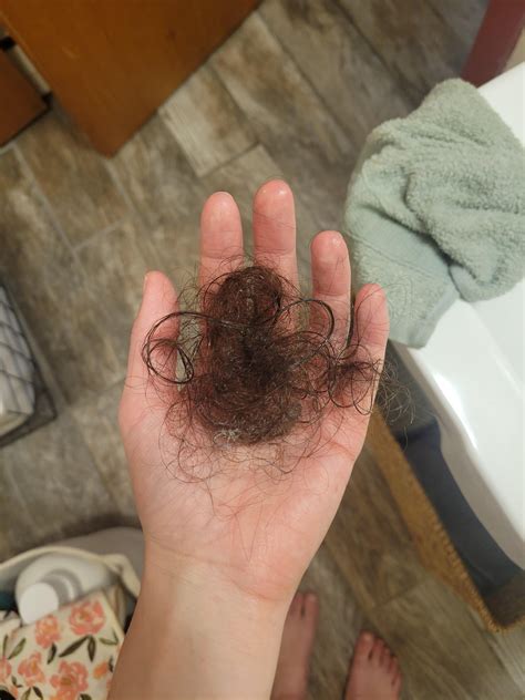 Crazy hair loss : r/Creatine