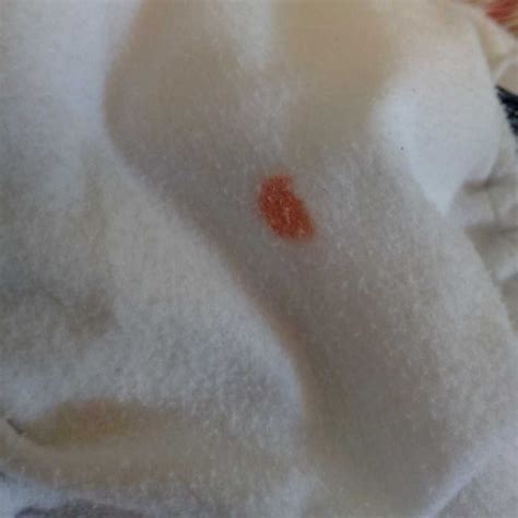 #asktheexpert hello doctor my baby is 5 months old and he is having ...