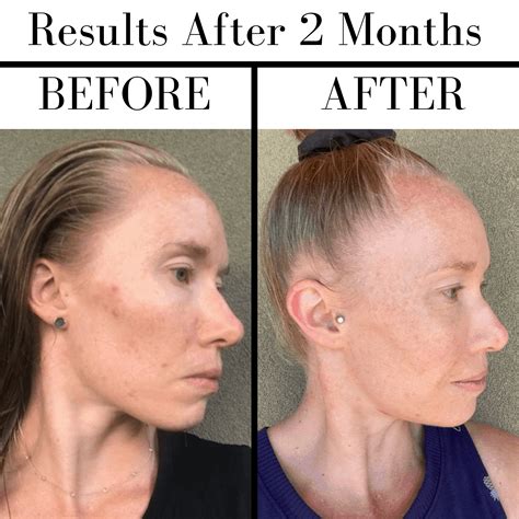 Beautycounter Vitamin C Serum Review - Pure and Simple Nourishment