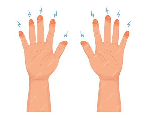 Premium Vector | Frozen hands in different stages. medical frostbite. stages of frostbite of ...