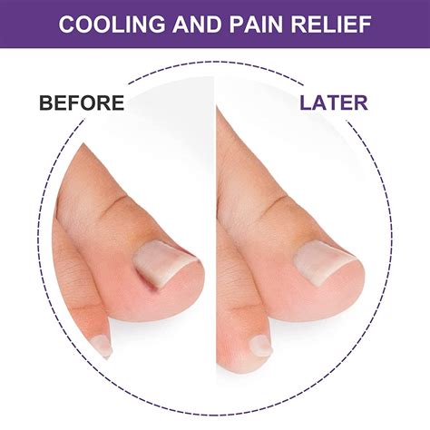 What Causes Toenail Bed Pain at Rose Thyer blog