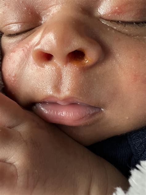 Orange/yellow mucus in 3 week old nostril : r/newborns