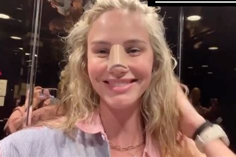 Meghan King shares recovery photos after nose, boob jobs