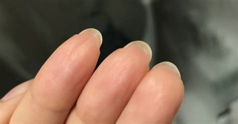 Hyponychium: Experts Explain Skin Growing Under Your Nails | POPSUGAR ...