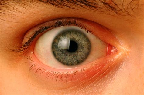 Iris Eye Types at Ricardo Fletcher blog
