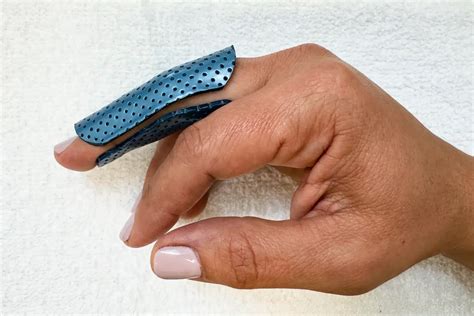 Expert Trigger Finger Treatment | Active Recovery Hand Therapy