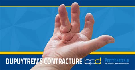 Understanding Dupuytren's Contractures - Brandon P. Donnelly, MD
