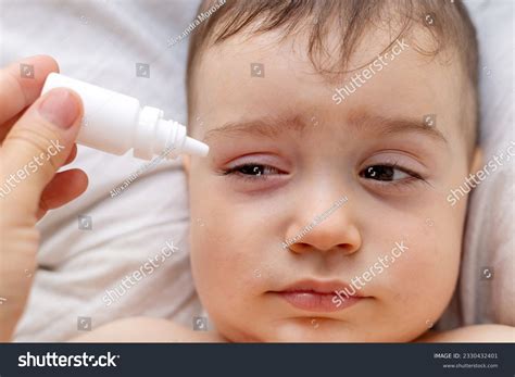 How To Reduce Discomfort In An Infant With Puffy Eyes - Watson Media