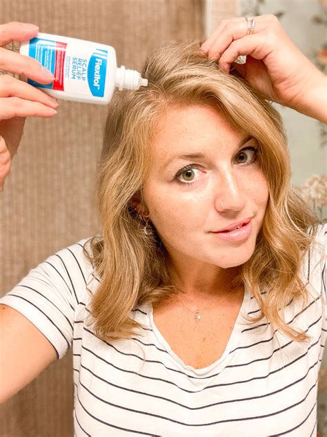 Eczema Scalp Treatment