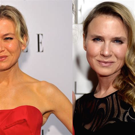Renee Zellweger Plastic Surgery
