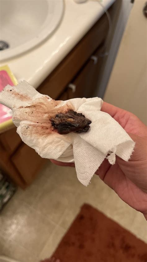 Large Blood Clots In Period