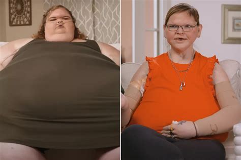 Tammy Slaton's surgeon reveals 'hardest moment' of skin removal surgery ...